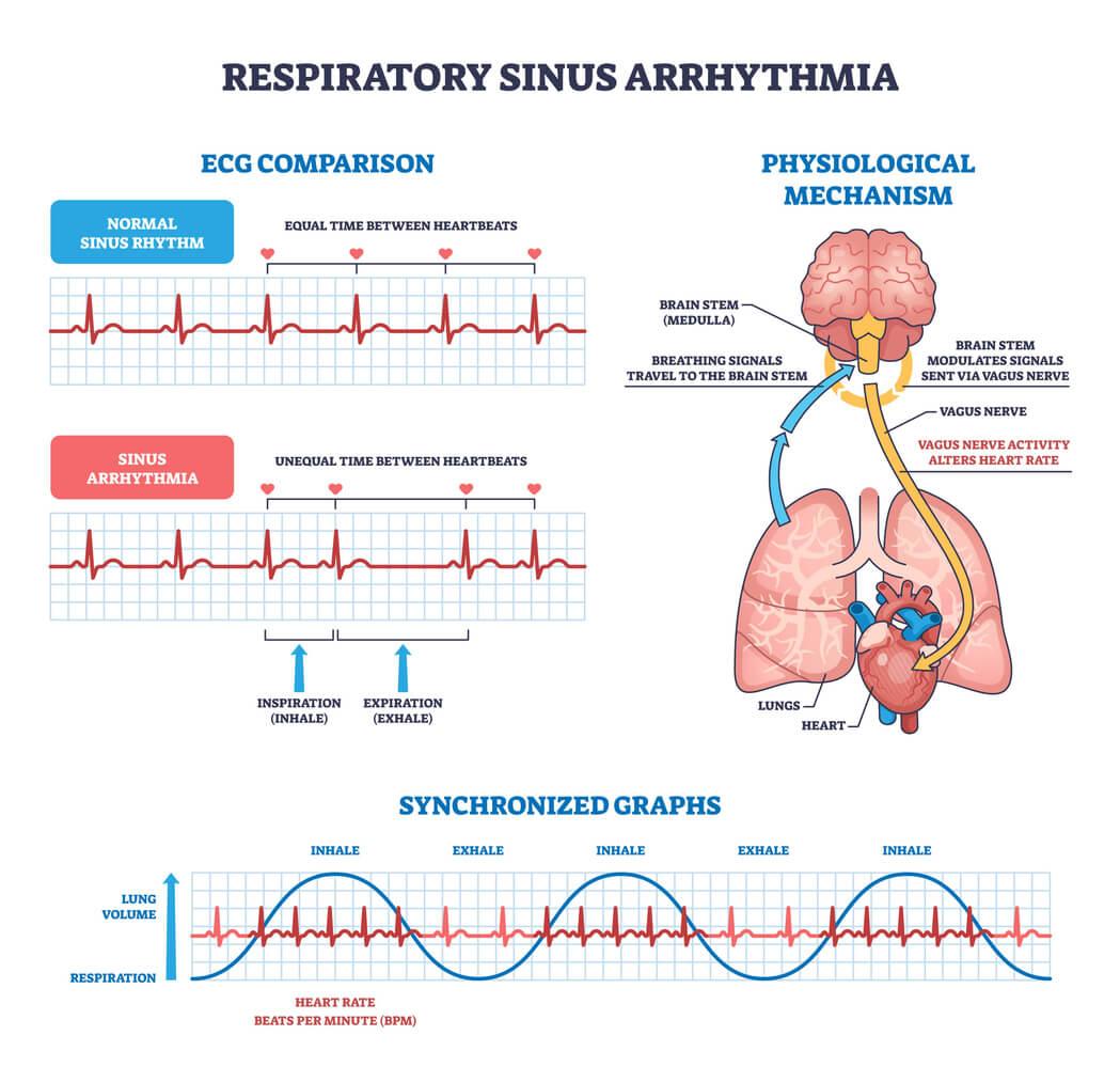 cpd-The-Breathwork-Reset-respiratory-sinus-arrhythmia