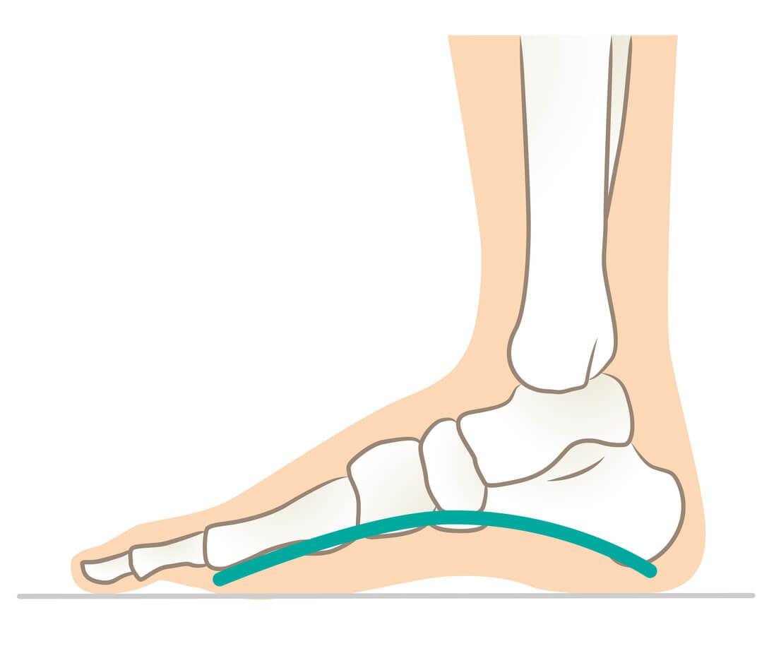 cpd-AIFiMM-Formazione-medial-plantar-arch