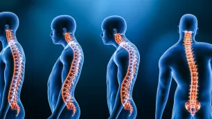 Vector Analysis of the Vertebral Column in the Frontal Plane – Part 2