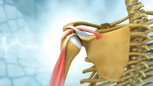 Biomechanical Analysis of the Shoulder — Part 2: Scapulohumeral Impingement, Subluxations and Therapeutic Implications