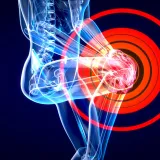 Biomechanical Analysis of the Lower Limb - Part 1: Vectorial Dominances of the Hip and Knee